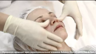 Ботокс Брыли Мимические морщины BEAUTY EXPERTIZA