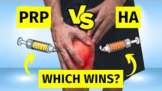 PRP vs Hyaluronic Acid Injections for Knee Arthritis