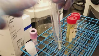 Urinalysis: Preparing the 3 patient urine specimens for microscopic analysis