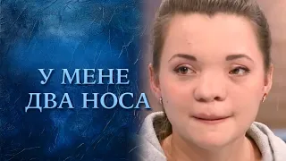 У меня два носа (полный выпуск) | Говорить Україна