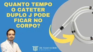 Duplo J: Quanto tempo pode ficar com ele?