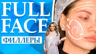 Full face. Контурная пластика филлерами на основе гиалуроновой кислоты.