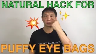 How to get rid of puffy eye bags naturally