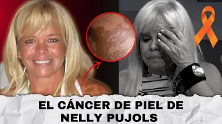 ASÍ LE CAMBIÓ LA VIDA A LA COMEDIANTE NELLY PUJOLS