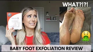 Baby Foot Exfoliation Foot Peel | Before and After Baby Feet Peel Off Mask- How To
