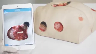 New SilhouetteLite+ Skin and Wound Assessment Device Demonstration