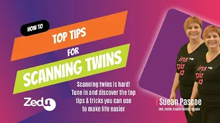How to: Top tips for scanning twins
