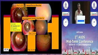 AIOCMTC2 2023 GP63 topic Dr Lalit Verma Intravitreal Injections in Endophthalmitis
