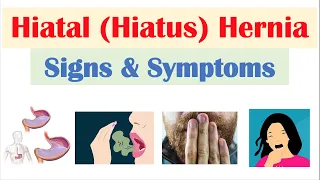 Hiatal (Hiatus) Hernia Signs & Symptoms (& Why They Occur)