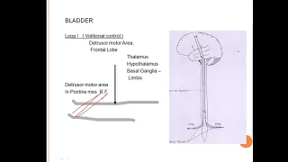 Neurogenic bladder