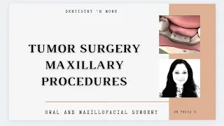 SURGICAL MANAGEMENT OF TUMORS -PART 2(MAXILLARY PROCEDURES)