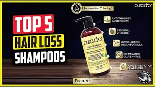 Best Hair Loss Shampoos for Men