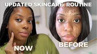 Benefits Of Skin Cycling On Face