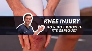 How do I know if my knee injury is serious?
