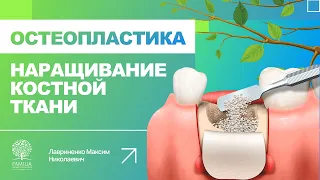 👆 Остеопластика - наращивание костной ткани