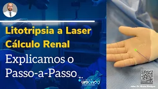 Litotripsia a Laser Explicada Passo a Passo. Entenda o tratamento de pedras nos rins.