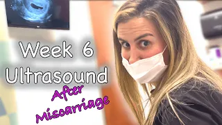 6 Week Ultrasound| Getting SneakPeak Gender Reveal Test | 1st Ultrasound after miscarriage Vlog 18