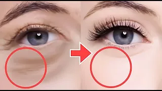 Eye Lifting Massage For Eye Bags, Eye Wrinkles, Dark Circles Under Eyes, Droopy Eyelids, Bigger Eye