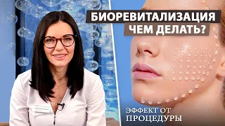 Лучшие препараты для биоревитализации