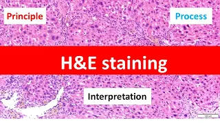 HE Staining: Principle, Procedure, and Interpretation | Haematoxylin and Eosin Staining |