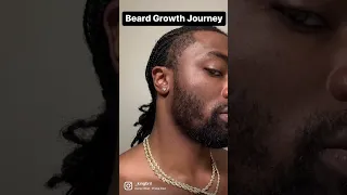 BEARD GROWTH 6 MONTH TRANSFORMSTION