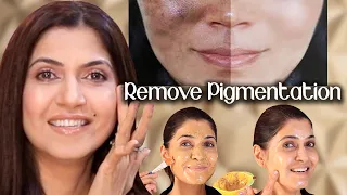 Get Rid of Melasma, Pigmentation, Discolouration Easily/ Home Remedy 2024 - Ghazal Siddique
