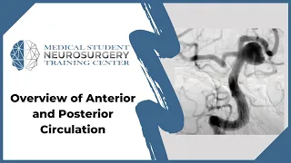 Overview of Anterior and Posterior Circulation