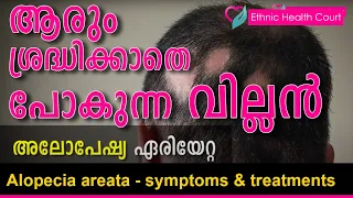 Alopecia areata - symptoms & treatments |അലോപേഷ്യ ഏരിയേറ്റ - മുടിപൊഴിയുന്ന രോഗം| Ethnic Health Court