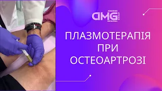 Плазмотерапія при остеоартрозі - проф. Олег Надашкевич. Медичний центр Академічна медична група AMG