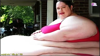 Top 8 personas con obesidad extrema que no creerás que existen