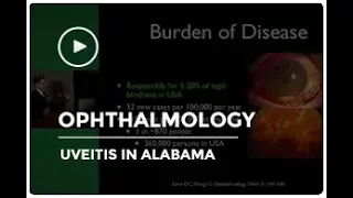 Uveitis in Alabama