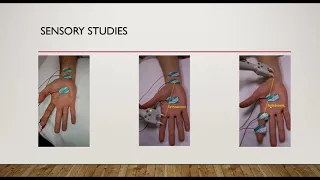 A basic intro to NCS/EMG for Neurologists