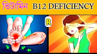 Vitamin B12 Deficiency Sign And Symptoms | B12 deficiency সকলোৱে জনা দৰকাৰ আছে
