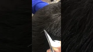 White hair removal