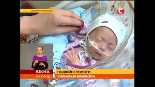 Унікальна трійня: подвійні пологи - Вікна-новини - 02.06.2015