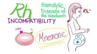 Rh incompatibility mnemonic