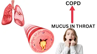 The 4 Causes Of Constant Mucus In Your Throat | Inspired By_ Dr. Eric Berg DC |