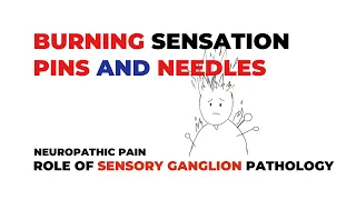 Neuropathic Pain and Sensory Ganglion Pathology