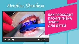 Как проходит профессиональная гигиена зубов для детей❓🤩