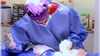 Shens Clinic - Korean-Style Short Incision Breast Augmentation (SIBA)