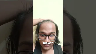 BALDING INDIAN LAD AMAZED WITH NEW BALD LOOK 🇮🇳