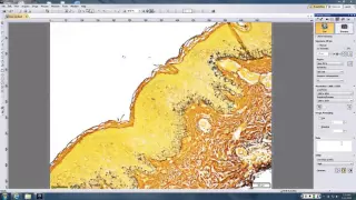 Dirk Elston Dermatopathology slides Spirochetal and Fungal Jan 11, 2016