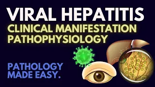 Viral Hepatitis I Pathophysiology Made Easy