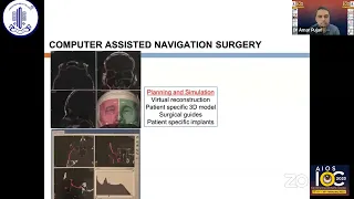 Orbital Trauma – Looking Into the Future - Dr Petrina Tan