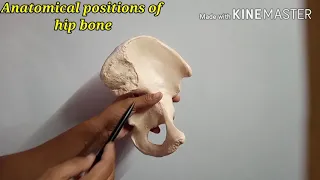 Anatomical position of hip bone.