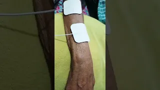 Stroke Hand Rehabilitation EMS TENS #shorts #physiotherapy #videos