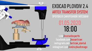 EXOCAD ARTEX TRANSFER SYSTEM. Алгоритм синхронной гипсовки