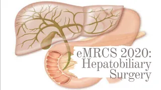 eMRCS 2020: Hepatobiliary Surgery