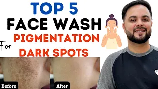 Top 5 Whitening Facewash to Remove Pigmentation & Dark Spots