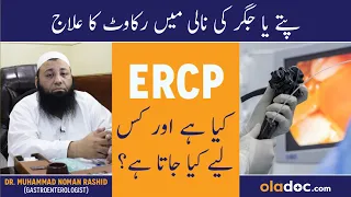 Pittay Aur Jigar Ki Naal Men Rukawat Ka Ilaj - What Is ERCP Procedure - ERCP Kyon Kiya Jata Hai